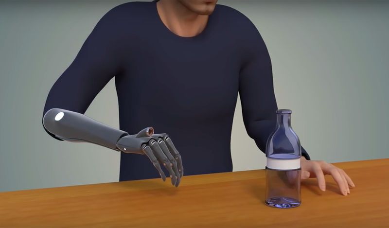 Intuitive Bionic Hands