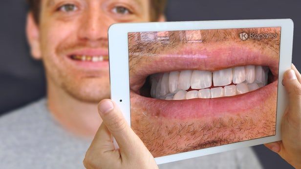 AR Dentistry Mirrors