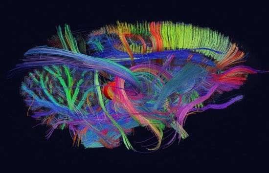 Colorful Brain Scans