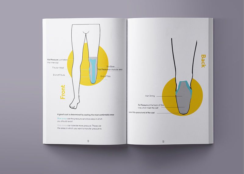 Design-Forward DIY Prosthetic Manuals