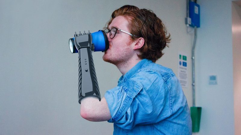 Affordable 3D-Printed Prosthetic