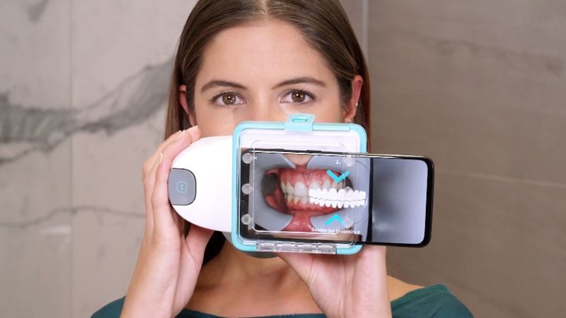 At-Home Oral Care Scanners