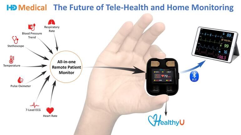 Remote Cardiac-Tracking Devices