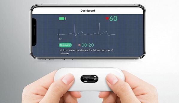 Portable ECG/EKG Monitor with OLED Screen- Detect Arrhythmias with Your  Fingers – Wellue