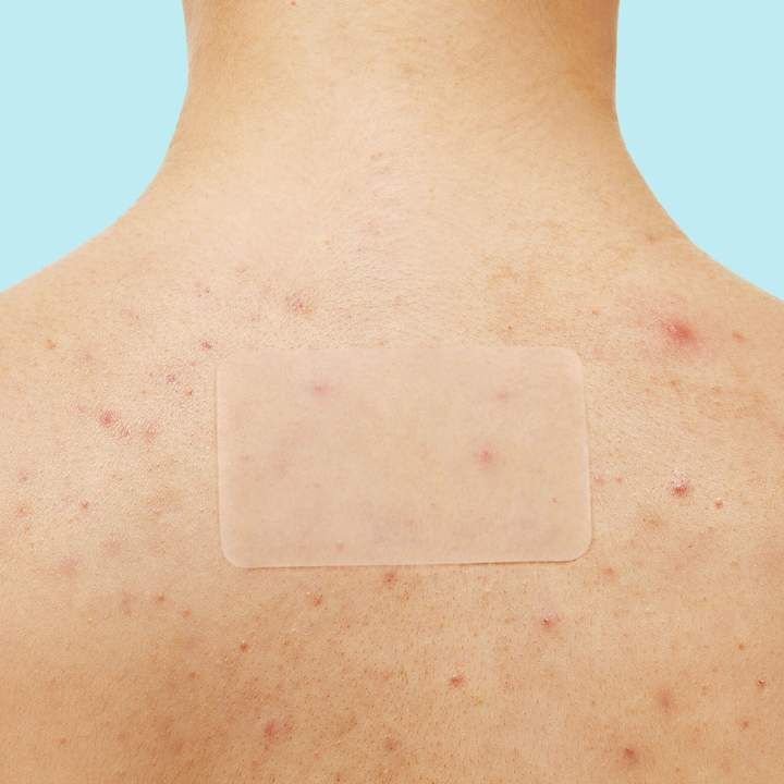 Extra-Large Acne Patches