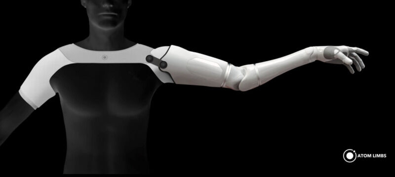 Mind-Controlled Artificial Arms : ai prosthetic arm