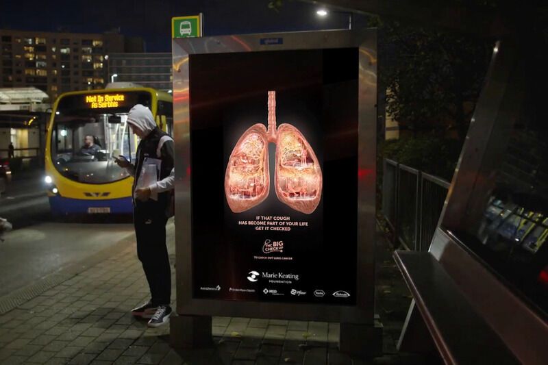 Lung Cancer-Awareness Campaigns : marie keating