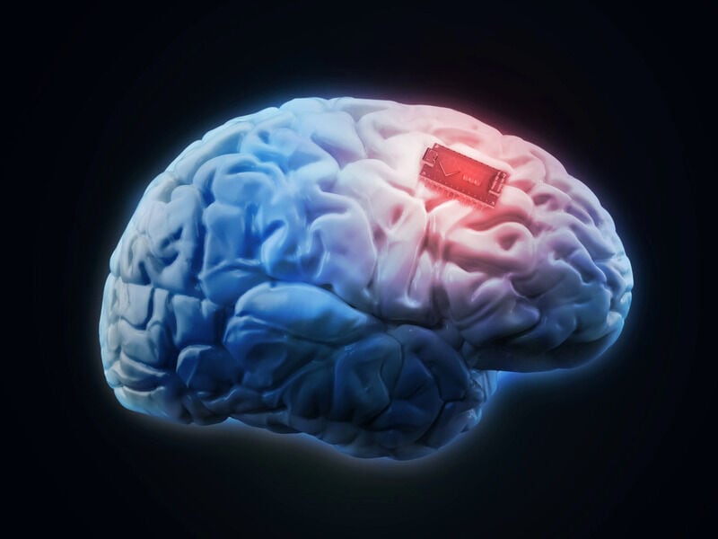 Electric Pulsed Brain Implants