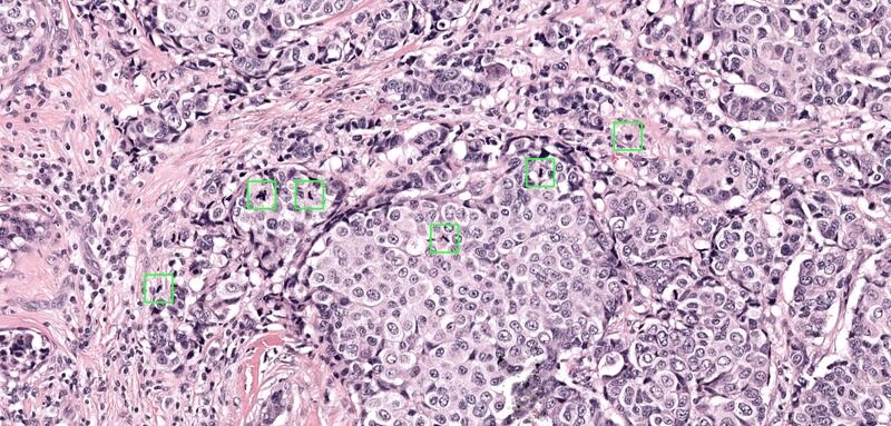 AI Mitosis Detectors