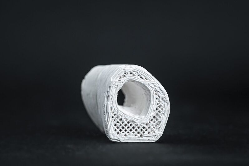 Patented 3D-Printed Bone Implants