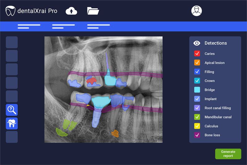 AI-Based Dental Analysis Programs
