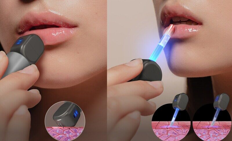 3-in-1 Lip Devices