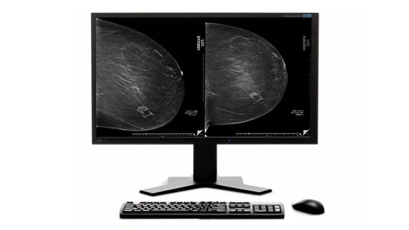 Breast Cancer AI Suites