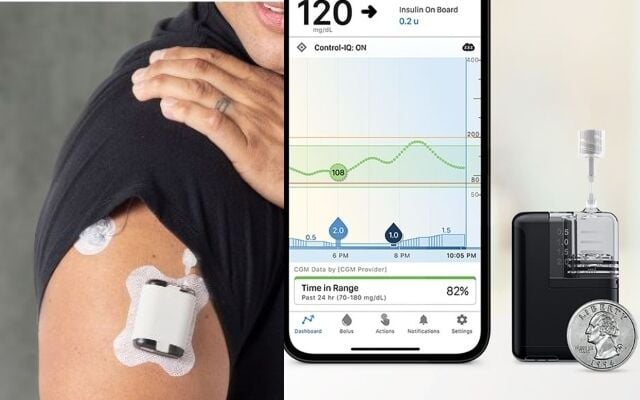 Automated Insulin Delivery Wearables : Tandem Mobi - JanPost