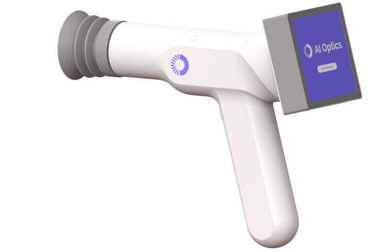 AI-Powered Retinal Screening Devices