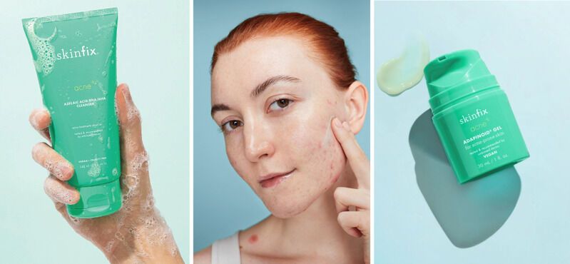 Daily Acne-Targeting Skincare Products