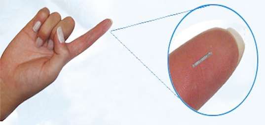 Implantable Glucose Sensors