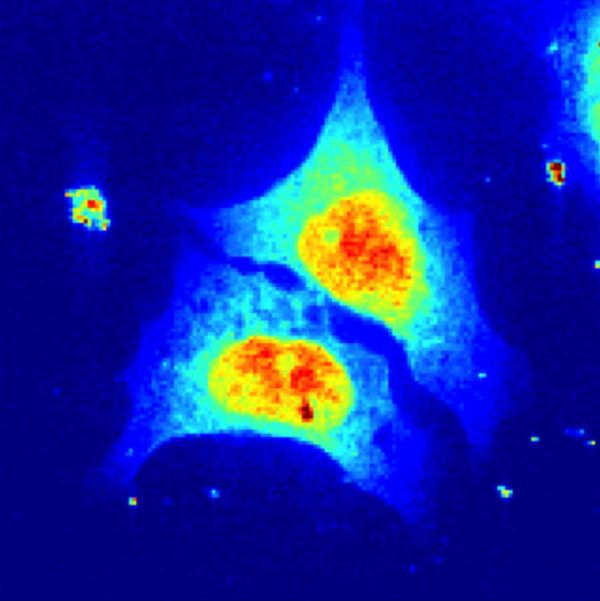 Breakthrough Cell X-Rays