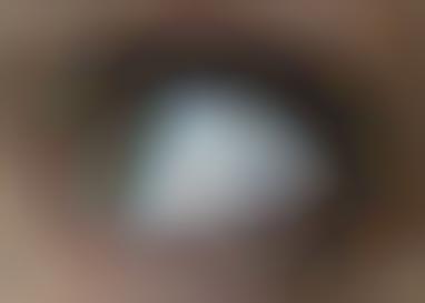 Image result for eyeball piercing