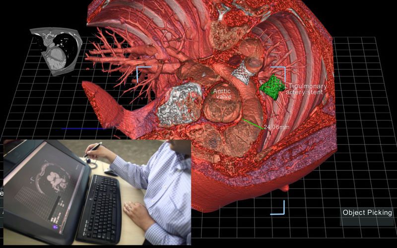 3D-Printed Medical Tools