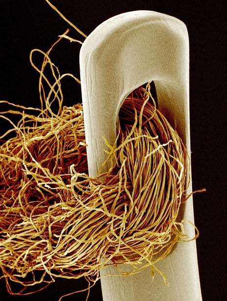 Amazing Microscopic Photography