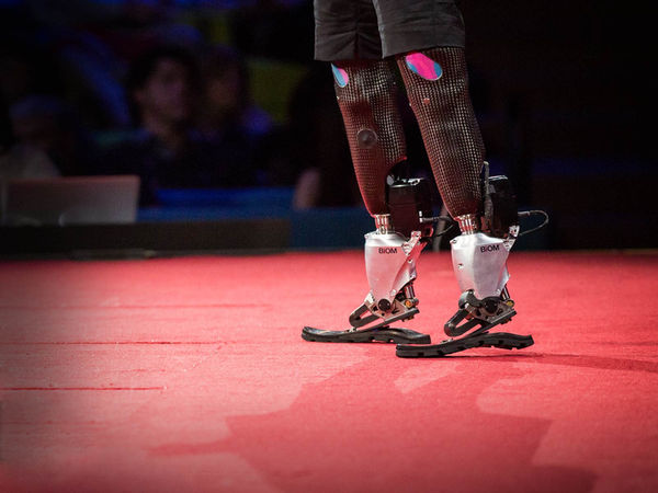 Bionic Advancement In Health : Ted Talk Bionic Limbs