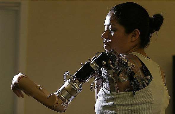 Thought Controlled Bionic Arm